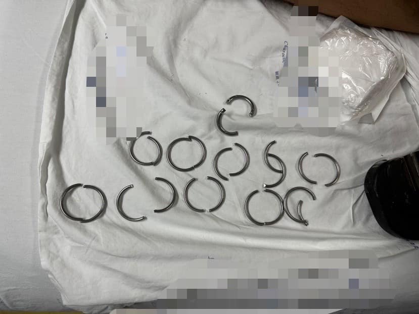 Ihm bleiben 11 Penisringe stecken und er geht ins Krankenhaus: Der Arzt rettet ihn mit einem Drahtschneider