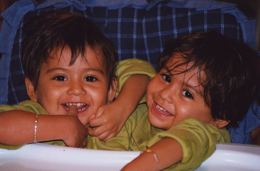 Siamesische Zwillinge beantworten peinliche Fragen: „Das passiert, wenn einer stirbt“