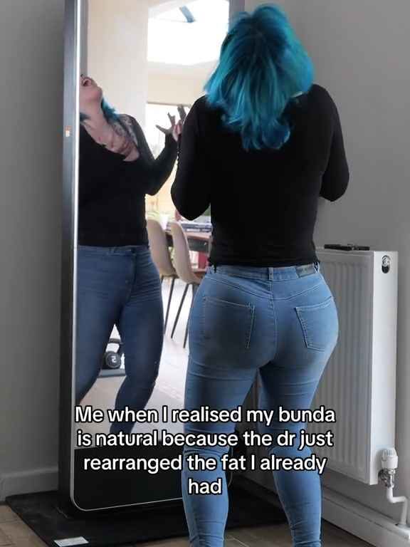 Modelo con implante gigante en el trasero descubre que no puede usar jeans