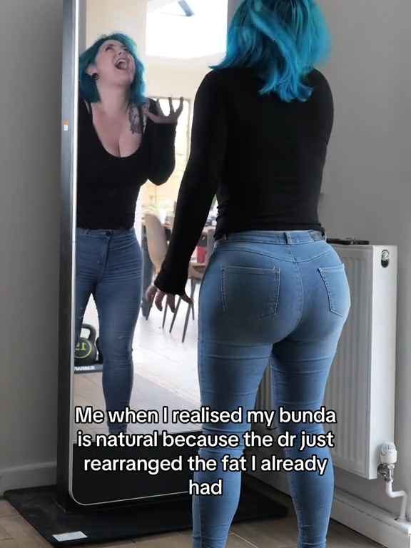 Model mit riesigem Po-Implantat stellt fest, dass sie keine Jeans tragen kann