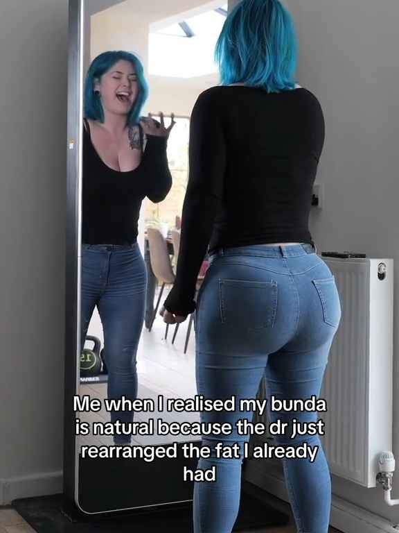 Model mit riesigem Po-Implantat stellt fest, dass sie keine Jeans tragen kann