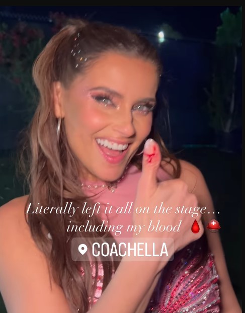 Nelly Furtado se estrella y sangra sangre en el escenario de Coachella