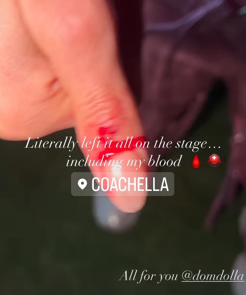 Nelly Furtado se estrella y sangra sangre en el escenario de Coachella