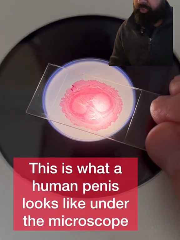 Un trozo de pene puesto bajo el microscopio: un vídeo científico causa sensación