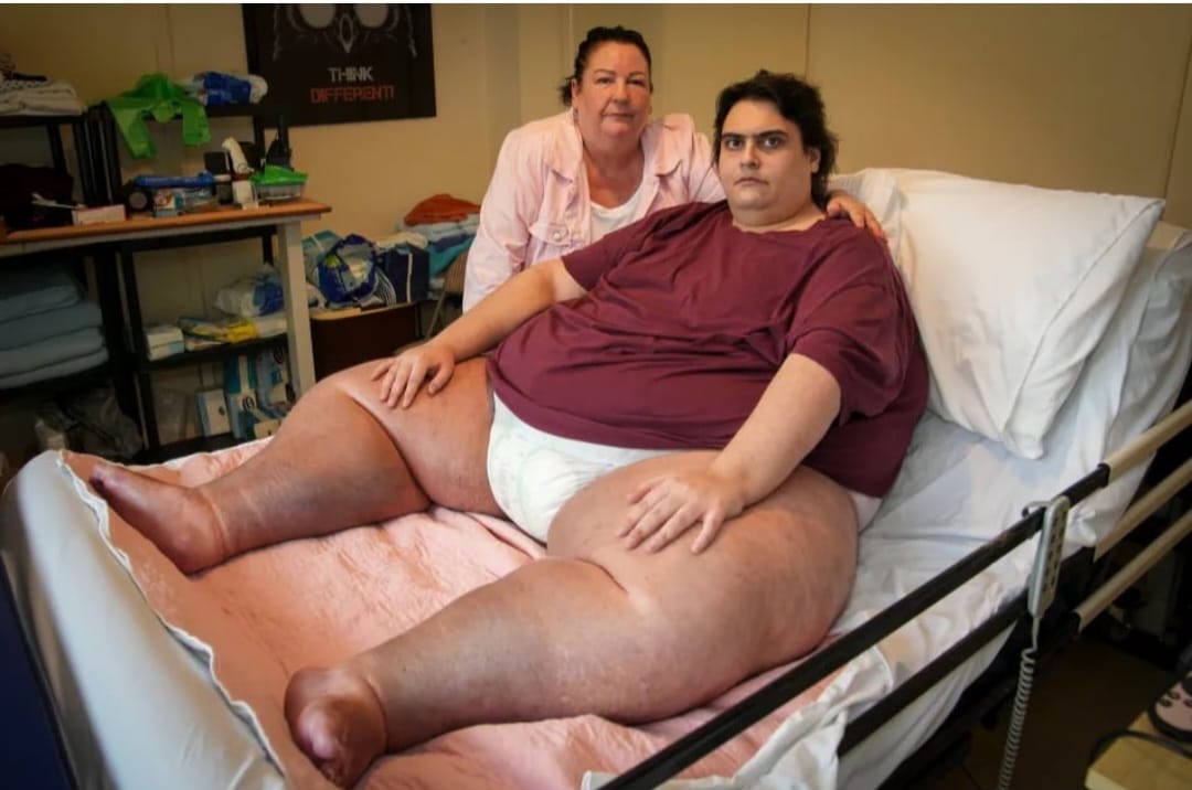 Der fettleibigste Mann Englands ist gestorben: Es ist nicht möglich, ihn einzuäschern, die Öfen sind zu klein
