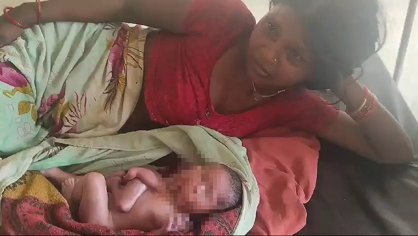 Neugeborenes mit zwei Gesichtern, vier Beinen und Armen: Die Mutter kann es nicht ernähren und es stirbt