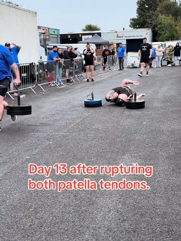 Le champion Strongman Dan Jones se casse les tendons et les rotules lors d'une compétition : vidéo choquante