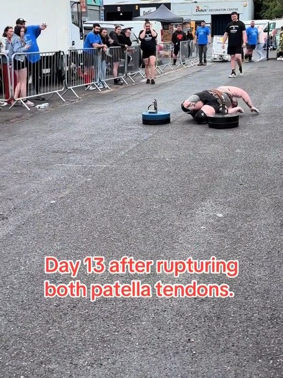 Le champion Strongman Dan Jones se casse les tendons et les rotules lors d'une compétition : vidéo choquante