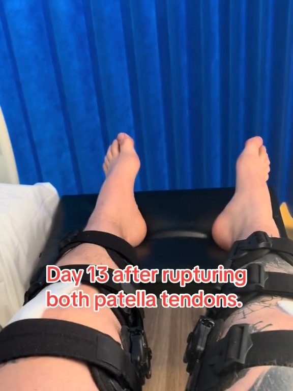 Le champion Strongman Dan Jones se casse les tendons et les rotules lors d'une compétition : vidéo choquante