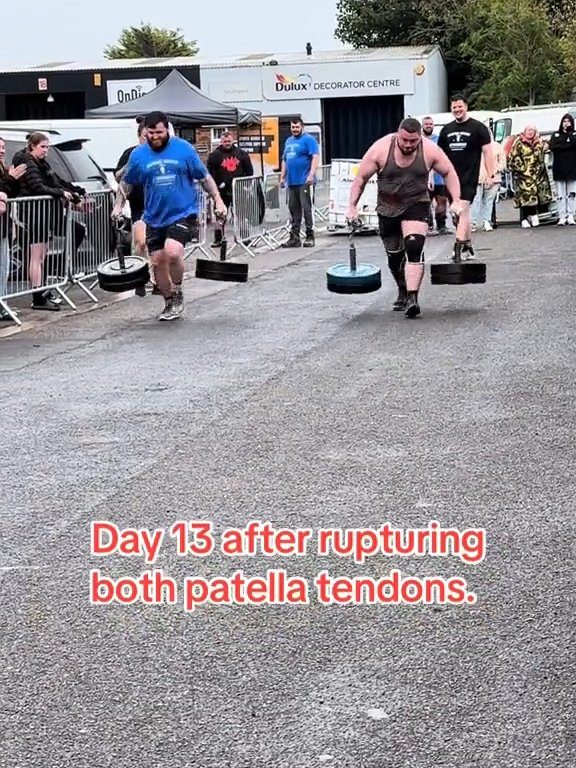 Le champion Strongman Dan Jones se casse les tendons et les rotules lors d'une compétition : vidéo choquante