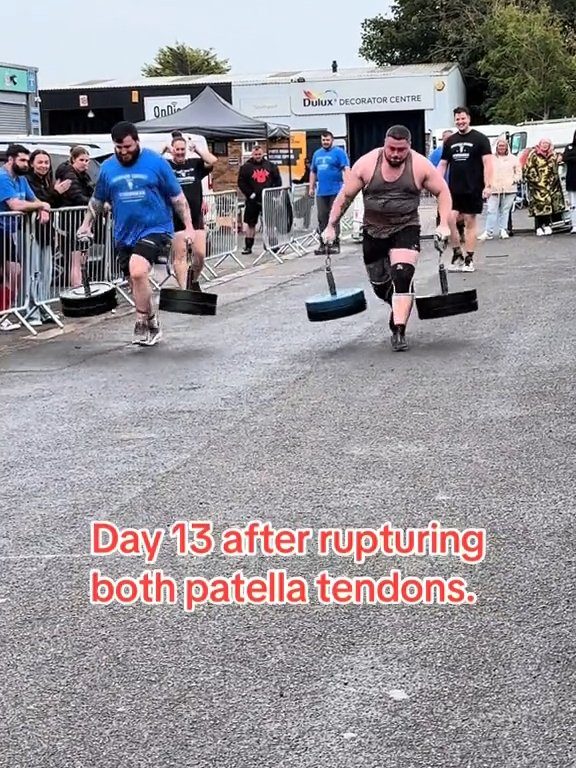 Le champion Strongman Dan Jones se casse les tendons et les rotules lors d'une compétition : vidéo choquante