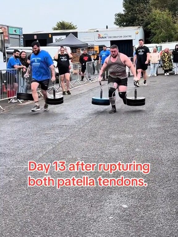 Le champion Strongman Dan Jones se casse les tendons et les rotules lors d'une compétition : vidéo choquante